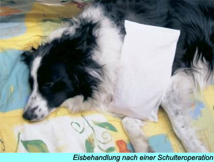 Eisbehandlung nach einer Schulteroperation